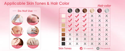 Before and after results with LumaSmooth IPL"